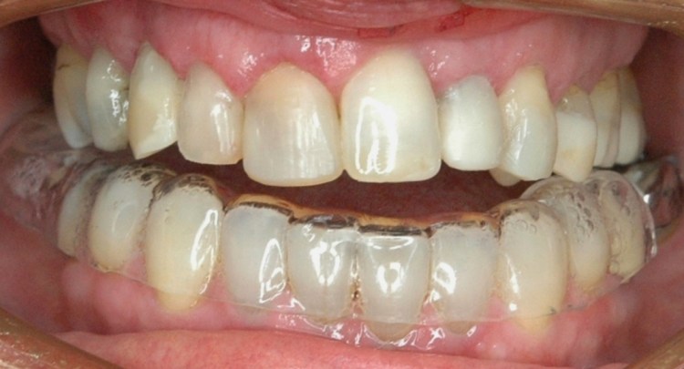 Review a month after work commenced