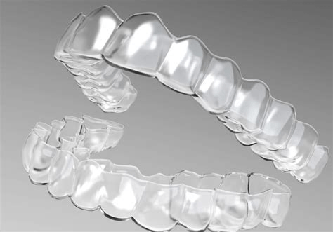 Soft Occlusal Splints or Orthodontic Aligners