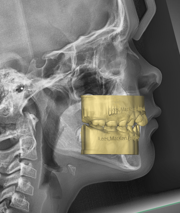 DIGITAL ORTHODONTICS