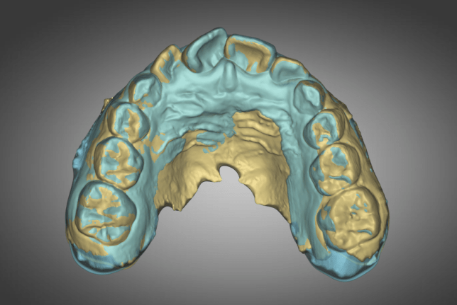 YELLOW = Initial 2022-10-29 vs BLUE = 1st Review 2023-03-01