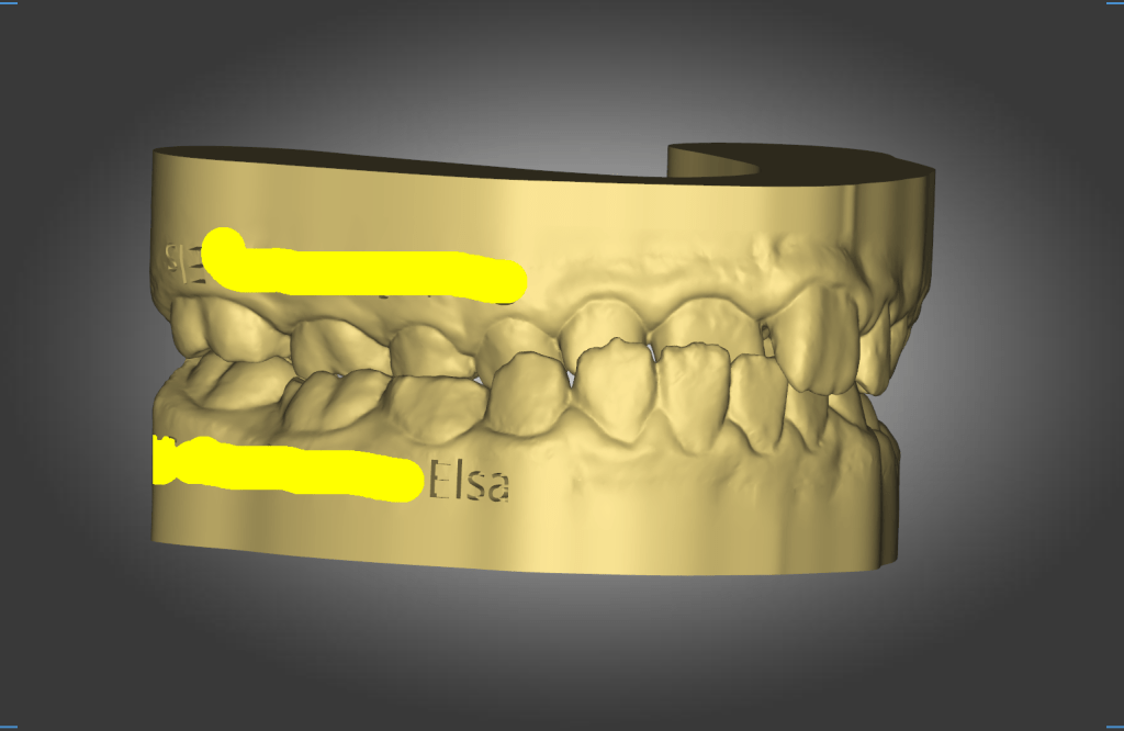 Elsa,G-H – Myofunctional Therapy&nbsp;(MFT)