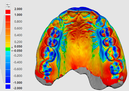Eva B. – Deep Bite, Upper Central&nbsp;Space