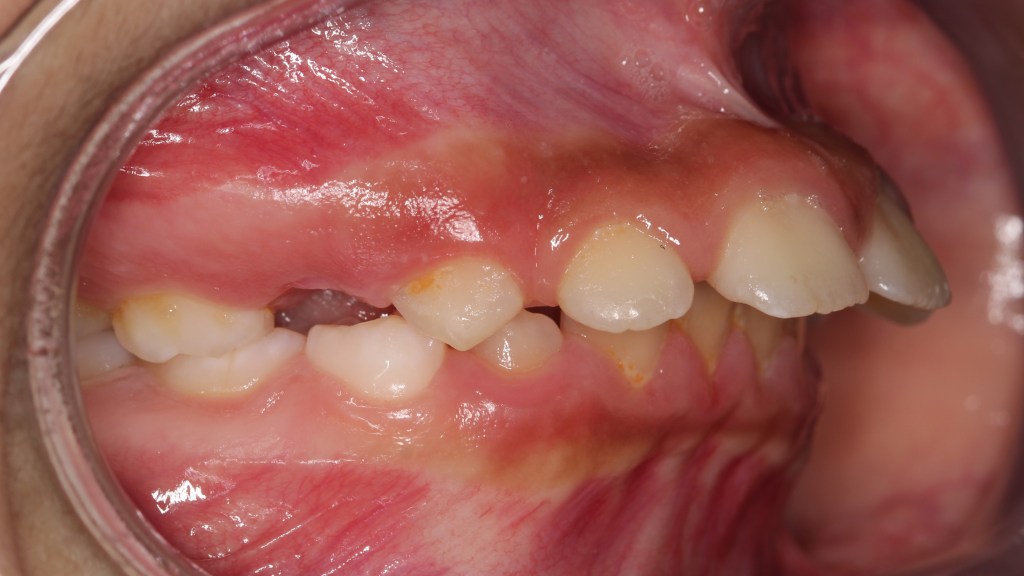 P-U, Dejanah – SA-MFT